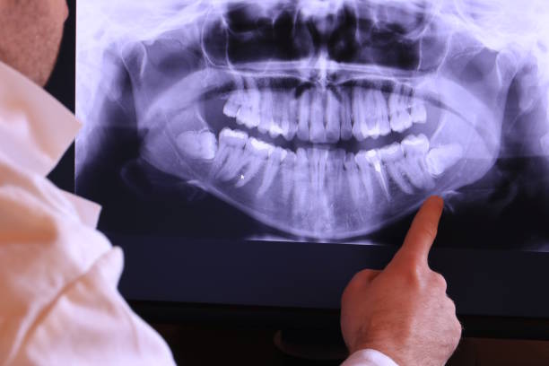 Best Emergency Treatment for Toothache in Ravena, NY